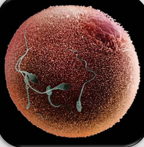 OPU and Ultrasonography