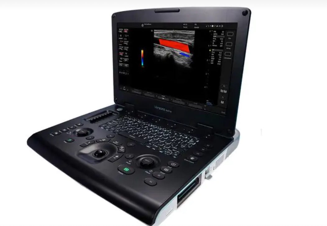 GE Ultrasound-Versana Active